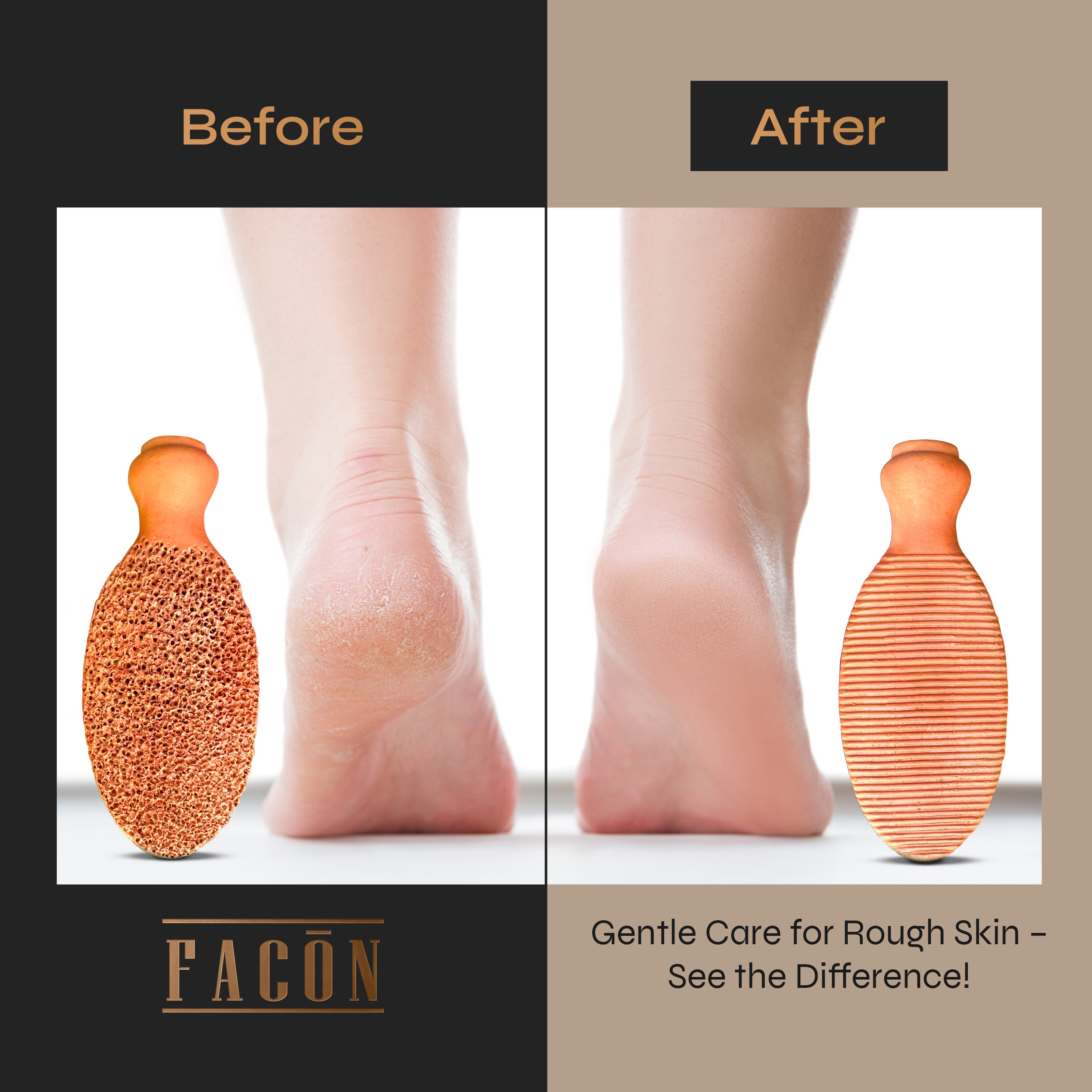Facón Pumice Stone for Feet Callus Remover - Terra-Cotta Foot Scrubber with 2 Sides, 100% Pure Natural Foot Pumice Stone, Pedicure Pumice Stone Scrubber, Foot Exfoliator, Removes Calluses & Dead Skin