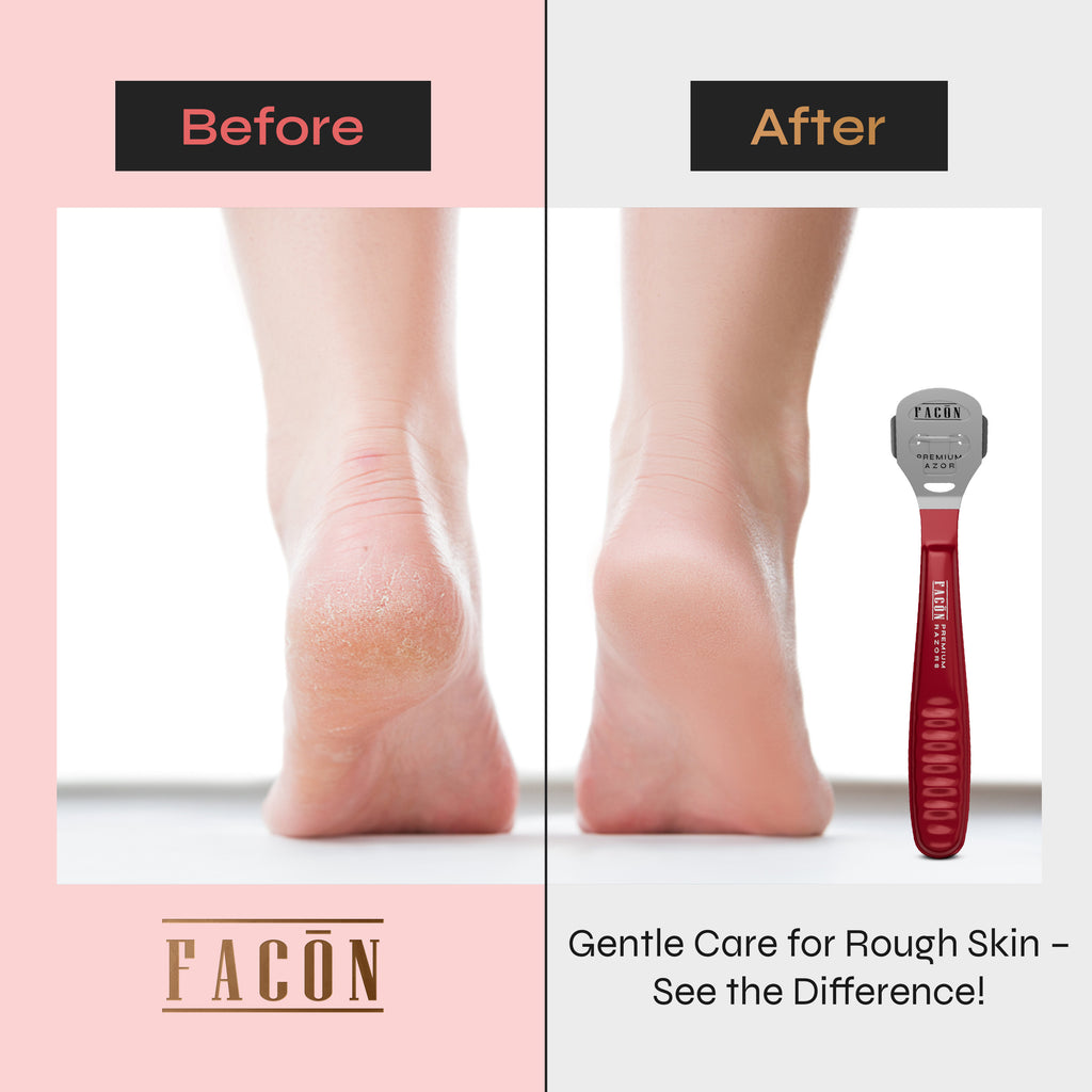 Facón Professional Callus Shaver Remover with 50 Blades, Pedicure Razor for Feet & Hands, Foot Razor for Callus Removal, Callus Blade Remover, Corn Shaver, Surgical Grade Premium Stainless Steel Tool