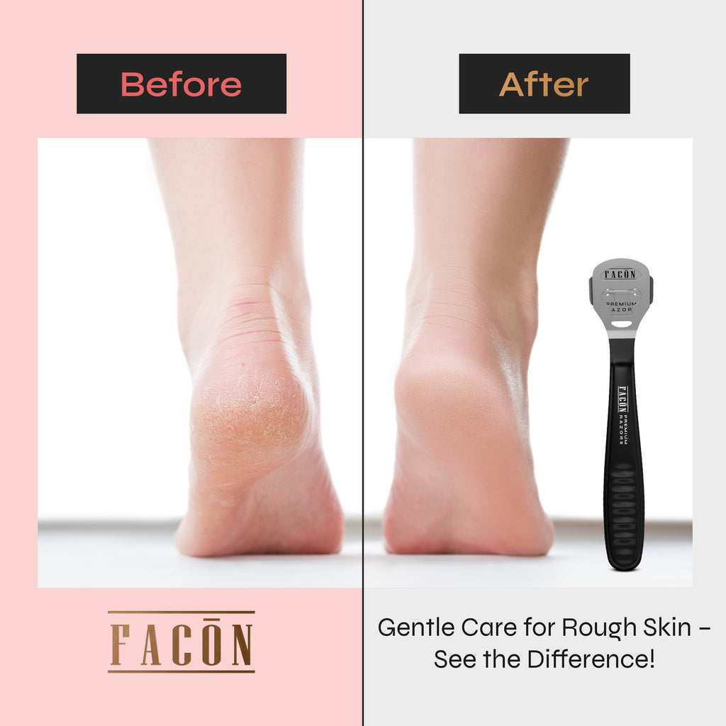 Foot Razor Installation Facón Professional Callus Shaver Remover with 50 Blades, Pedicure Razo ...