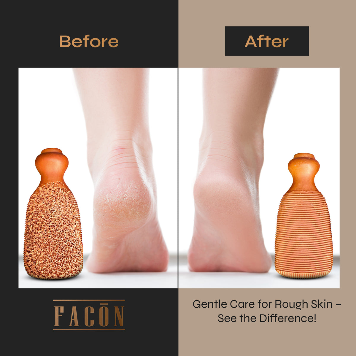 Foot Corn Razor Facón Pumice Stone for Feet Callus Remover - Terra-Cotta Foot Scrubber ...