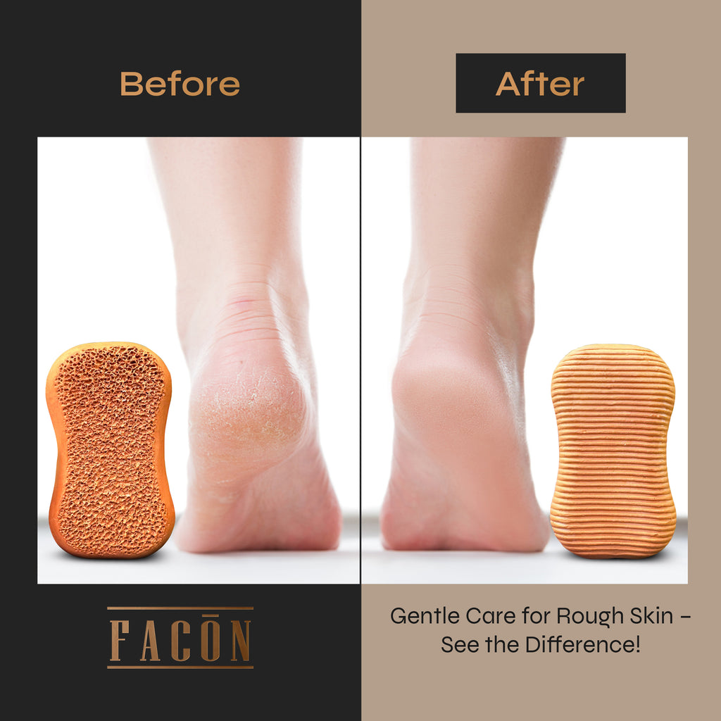 Facón Pumice Stone for Feet Callus Remover - Terra-Cotta Foot Scrubber with 2 Sides, 100% Pure Natural Foot Pumice Stone, Pedicure Pumice Stone Scrubber, Foot Exfoliator, Removes Calluses & Dead Skin