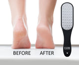 Facón Professional Pedicure Foot File 3-in-1 Callus Remover with Mini File - Premium Laser-Cut Surgical Grade Stainless Steel - Removes Calluses, Corns & Rough Skin