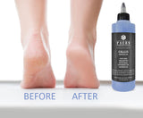 Facón Professional Clear Callus Remover Gel for Feet with Skin Soothing Aloe Vera & Shea Butter, Cooling Menthol Peppermint Oil & Witch Hazel, Calming Lavender Oil Scent - Removes Calluses, Corns & Rough Skin (10 fl oz / 296 ml)
